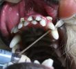 Задържане на млечните зъби