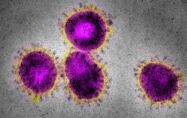 Как да предпазим от коронавируса домашните си любимци?

 